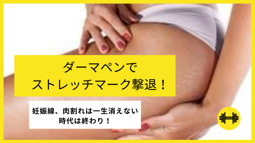 ダーマペンで妊娠線 肉割れ ストレッチマーク が消せる Beauty Med